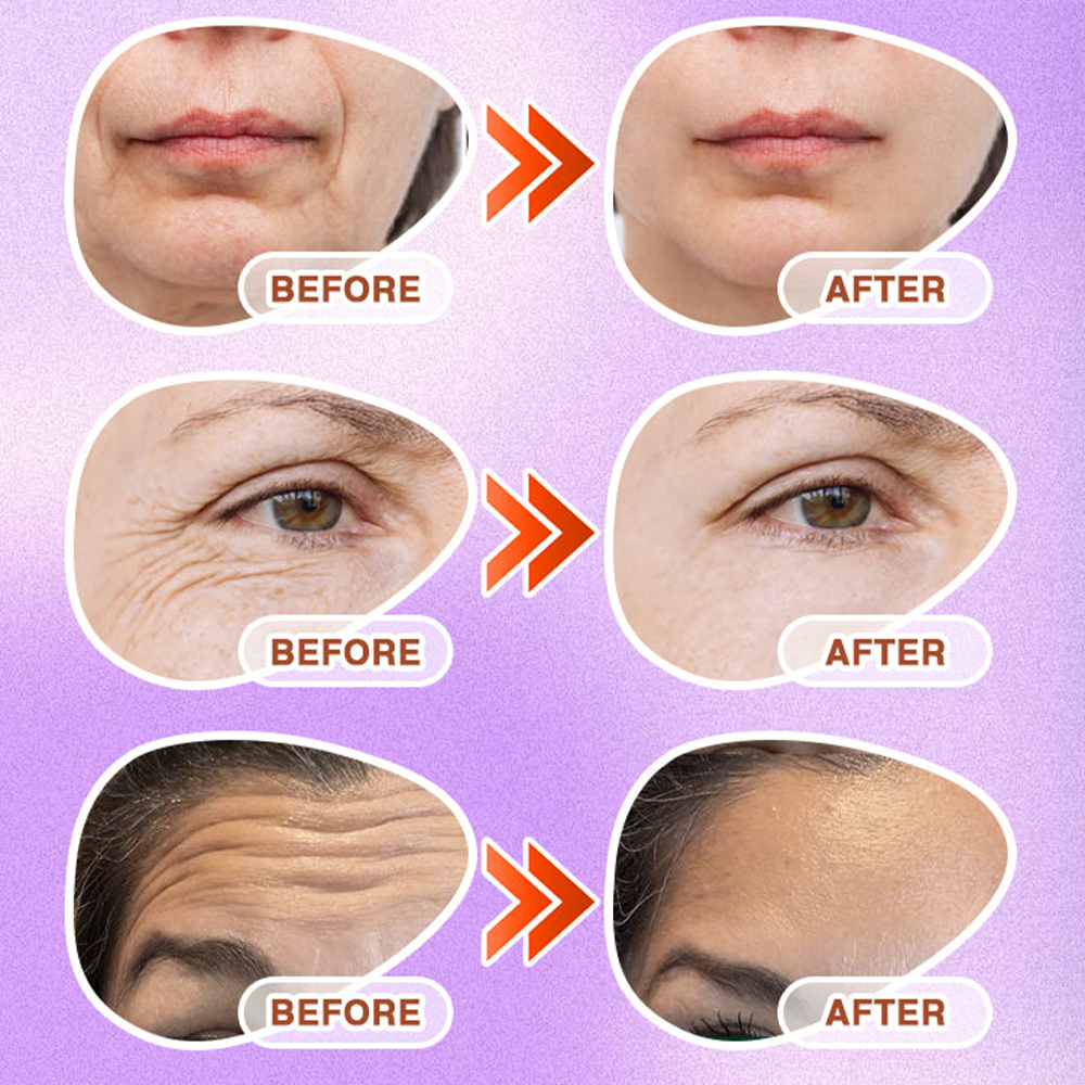 NATRAVOR® 3-in-1 Microneedle Anti-Aging Patch
