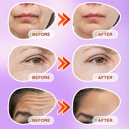 NATRAVOR® 3-in-1 Microneedle Anti-Aging Patch